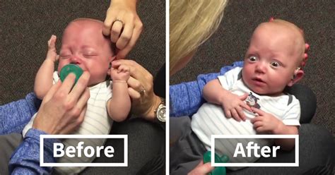 Baby Hears Mom For The First Time After Receiving Hearing Aids And His