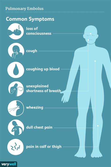 Symptoms Of Pulmonary Embolism