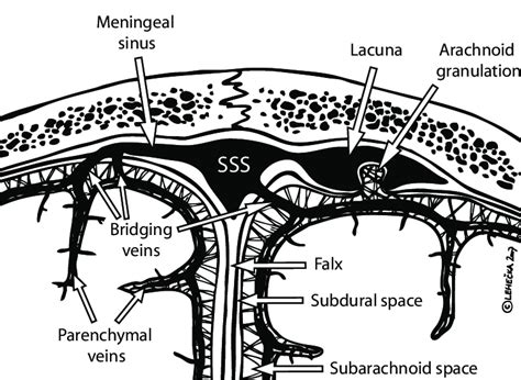 The Superior Sagittal Sinus Sss And Its Relation To Venous Lacunae