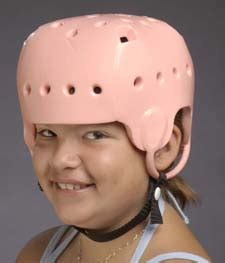 Down syndrome, also called trisomy 21, is the most common autosomal chromosomal irregularity, occurring in approximately 1:700 live births. Danmar Soft Shell Protective Helmets for Children and Adults
