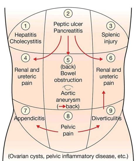 Pain Associated With Abdominal Quadrants Medizzy