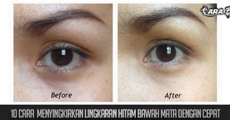 Bagian bawahnya begitu rendah sehingga memperlihatkan paha putihnya yang mulus dan berisi. 10 cara menyingkirkan lingkaran hitam bawah mata dengan ...