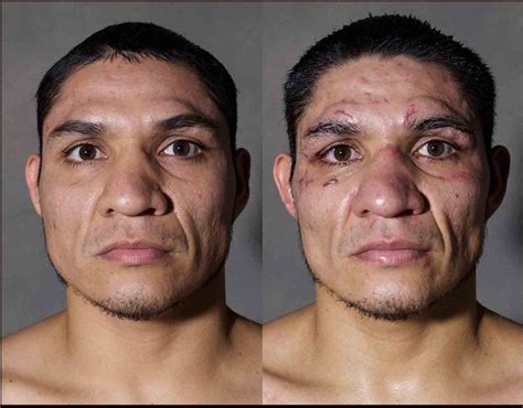 7 Boxers Before And After They Were Punched In The Face