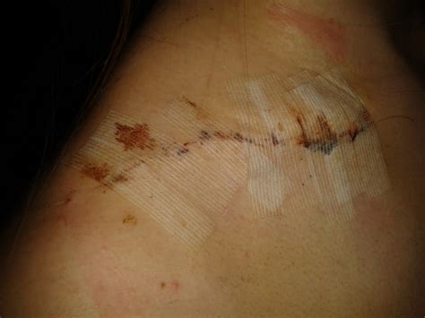 I love back bones that stick out they are sooo pretty! Left-Handed Student Life : My Collar Bone- The Untold Story