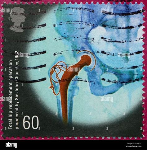 Photo Of A British Postage Stamp From The Medical Breakthroughs Series
