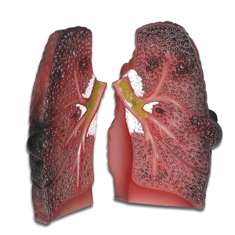 Cough Up A Lung Model 78958 Smoking Education Health Edco