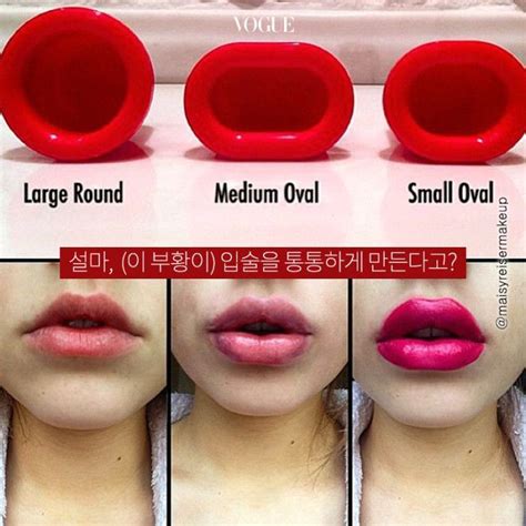Latest Lip Plumping Fad Shaped Suction Cups Used For Secs Effects Apparently Last For Hours