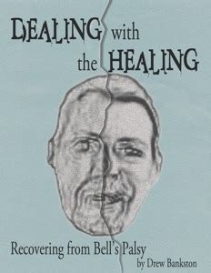 Dealing With The Healing Recovering From Bell S Palsy By Drew Bankston