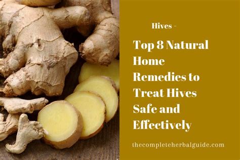 Pin On Hives Remedies