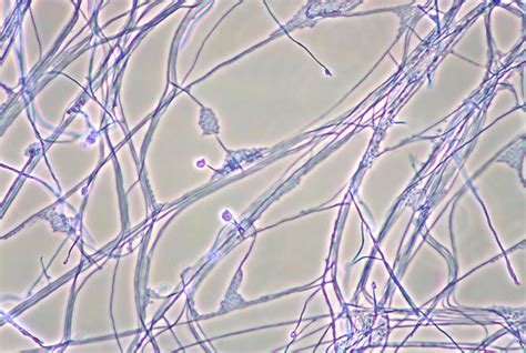 Microscopic Images Of Fungi