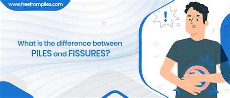 What Is The Difference Between Piles And Fissures Freefrompiles