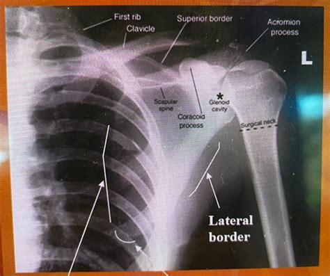 Scapula Clavicle And Ac Joints Flashcards Quizlet