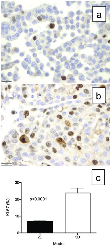 Ki 67 Staining For Cell Proliferation Index Representative Ki 67