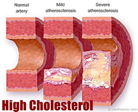 Sixty thousand miles of blood vessels transport the blood, enough to encircle earth more than twice. What Your Doctor May Not Tell You About Cholesterol ...