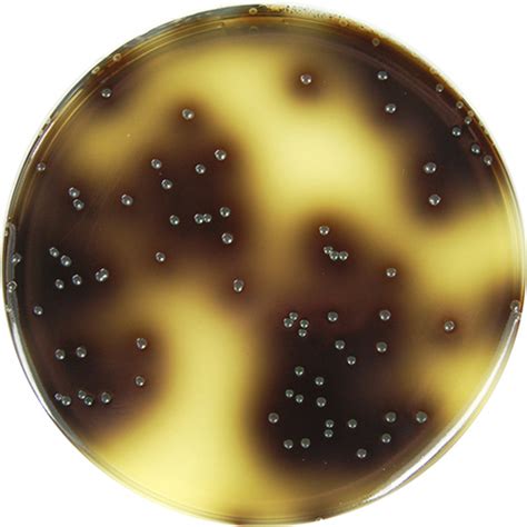 Listeria monocytogenes is a bacterium that causes listeriosis, a disease that can have severe consequences for particular groups of the population. PP0630 - Listeria (Oxford) Agar - E & O Laboratories Ltd