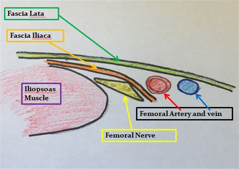 Filefemoral Nerve Block Anatomypng Wikem