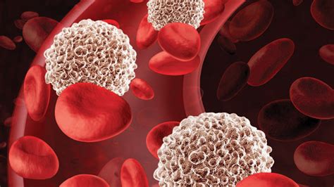 Enhance Healing Using Leukocyte Platelet Rich Fibrin Decisions In