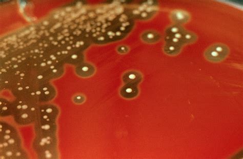 Streptococcus Pyogenes Colonies Growing On Blood Wellcome Collection