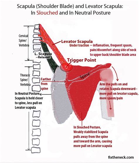 Most common causes are as. 17 Best images about stretches on Pinterest | Muscle, Back ...