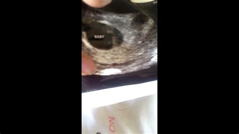 We Are Having A Baby After Miscarriage 8 Weeks Youtube