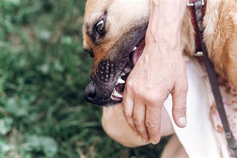 Can Dog Bites Cause Nerve Damage Pushchak Law Denver