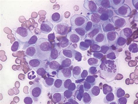 Cytology Common Neoplastic Skin Lesions In Dogs And Cats