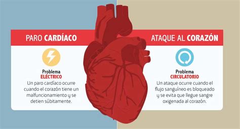 ¿qué Diferencia Hay Entre Un Ataque Y Un Paro Cardíaco Practiman