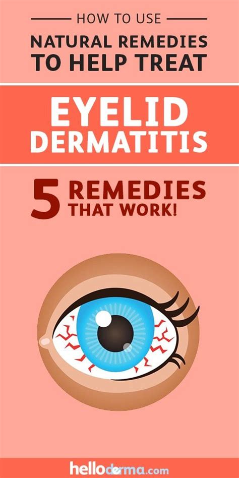 5 Natural Remedies To Treat Eyelid Dermatitis Eyelid