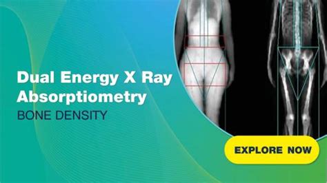 Dual Energy X Ray Absorptiometry Dxa Iaea