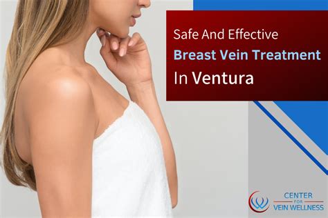Safe And Effective Breast Vein Treatment In Ventura
