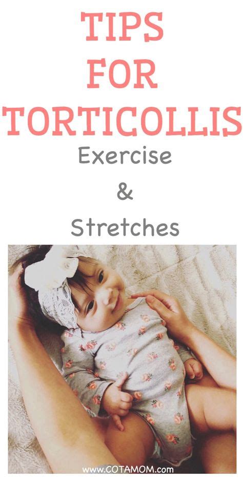 Tips For Torticollis Exercise And Stretches Torticollis Torticollis