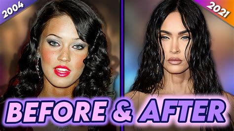 Megan Fox Before And After Plastic Surgery Botox And Mgk Punk Effect