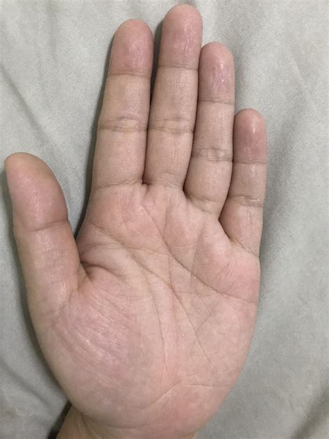 Hi This Is My Left Hand Ive Read Somewhere That In Females Left Hand