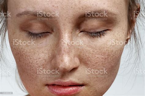 억제하여 기미와 주근깨의 생성을 가진 여자 눈 감기에 대한 스톡 사진 및 기타 이미지 눈 감기 주근깨 닫은 Istock