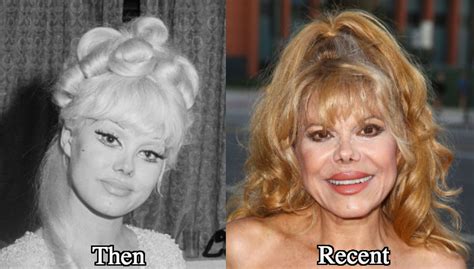 Charo Plastic Surgery Before And After Photos Latest