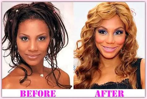 Before And After Plastic Surgery Tamar Braxton