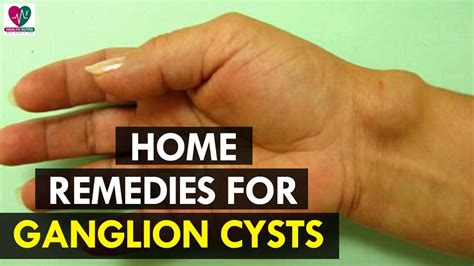Home Remedies For Ganglion Cysts Health Sutra Youtube