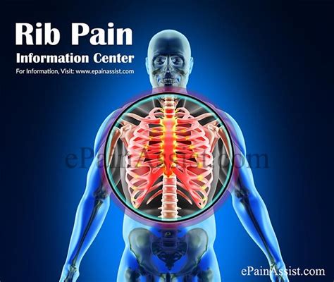 Sore Rib Cage Muscles 14 Causes Of Pain Under Right Rib Cage In