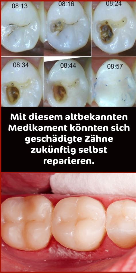 Sebastian gothe von artistravel beginnt heute eine reihe von kurzen zeichenlektionen für anfänger. Mit diesem altbekannten Medikament könnten sich ...