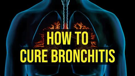 How To Cure Bronchitis Fast 5 Quick Ways Youtube