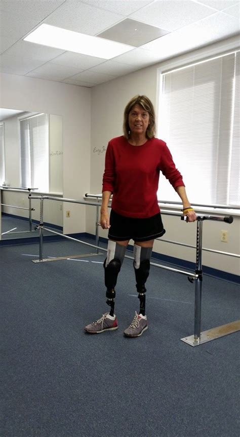 Attraction To Imperfect Bodies Nearly 60 Year Old Woman Who Lost Legs