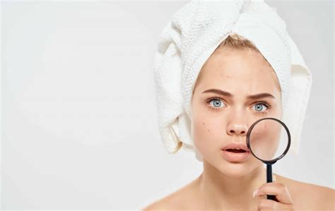 10+ Most Common Skin Problems and their Best Natural ...