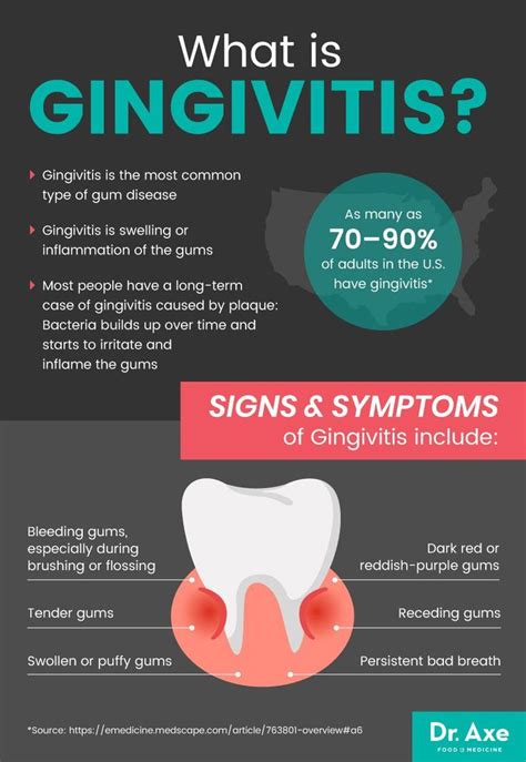 Protect Your Gums How To Get Rid Of Gingivitis Symptoms In 2020