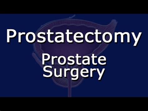 Prostatectomy Prostate Surgery Youtube