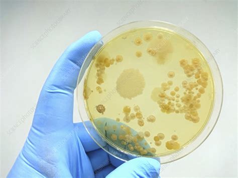 Colony Of Bacteria On Culture Medium Stock Image F0323271
