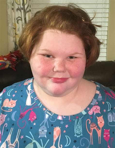Alexis Shapiro Texas Girl Who Faced Extreme Weight Gain Is Doing