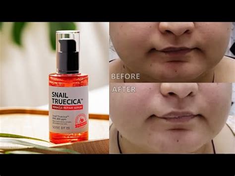 It's free of harmful alcohols, allergens, gluten, sulfates, fungal acne feeding components, parabens, silicones, polyethylene glycol (peg) and synthetic fragrances. SOME BY MI Snail Truecica Miracle Repair Serum | Korean ...