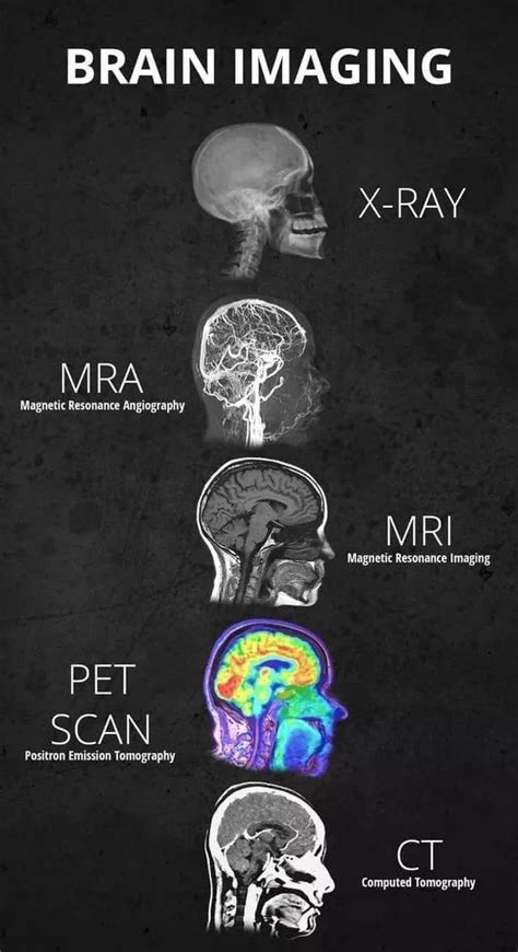 Types Of Brain Imaging Techniques Medical Knowledge Radiology
