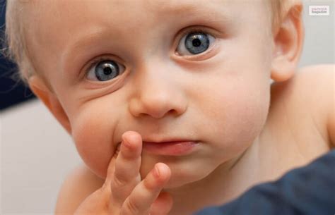 Understanding And Treating Drool Rash In Babies A Comprehensive Guide