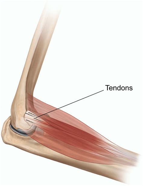 Elbow Tendon Injury Symptoms